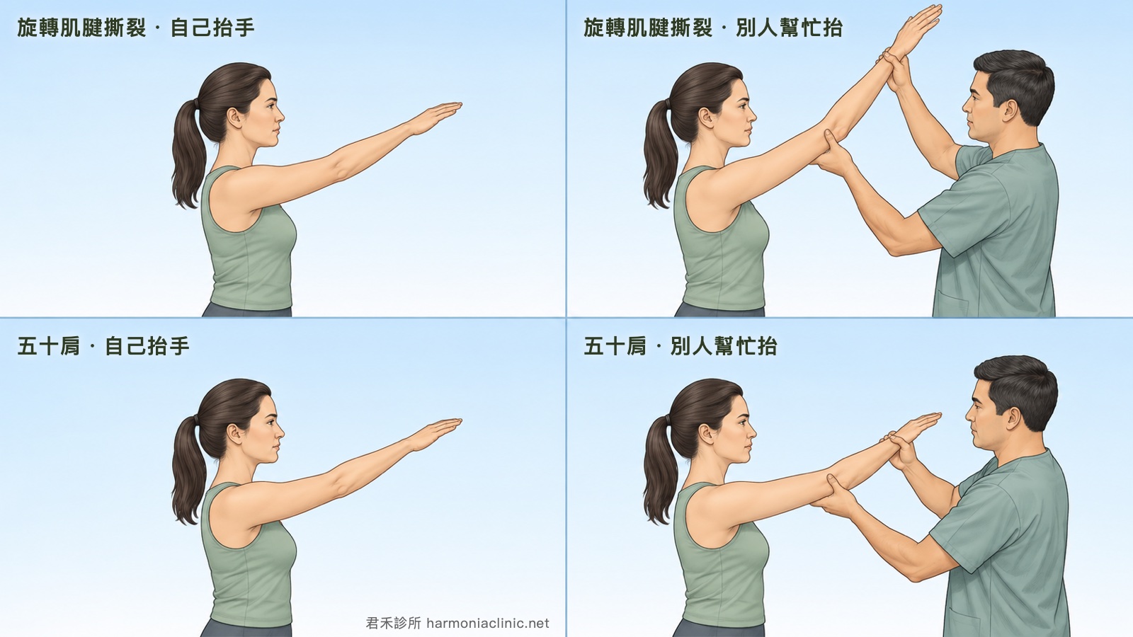五十肩與旋轉肌腱撕裂的動作差別示意圖:上列為旋轉肌腱撕裂,自己抬手只能抬到與肩同高,但檢查者托著手臂往上時可以抬到高位;下列為五十肩,自己抬手同樣只到與肩同高,檢查者幫忙抬時手臂仍然停在同樣的高度